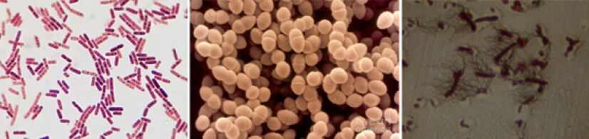 Escherichia Stick, Fecal Enterococcus and Pro - The main pathogens of chronic prostatitis
