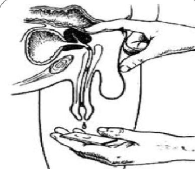Prostate massage to get secretion