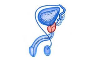 Drawing prostatitis